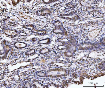 Anti-UBA6 Antibody