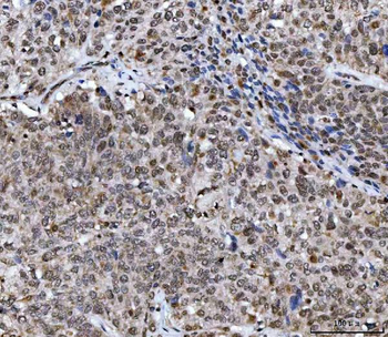 Anti-UBA6 Antibody