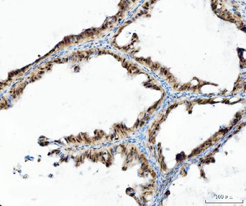 Anti-UBA6 Antibody