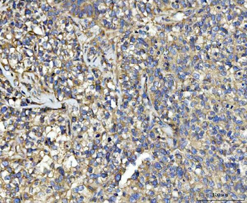 Anti-UBA5 Antibody