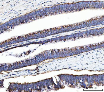 Anti-UBA5 Antibody