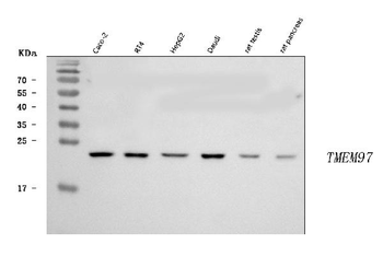 TMEM97 Rabbit Polyclonal Antibody