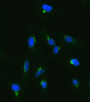 TJAP1 Antibody