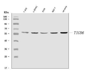 TIGD6 Antibody