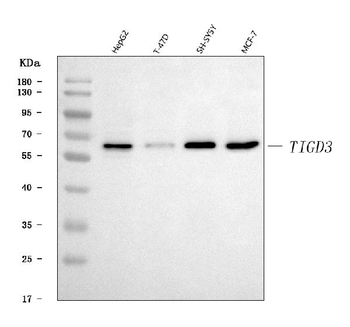 Anti-TIGD3 Antibody