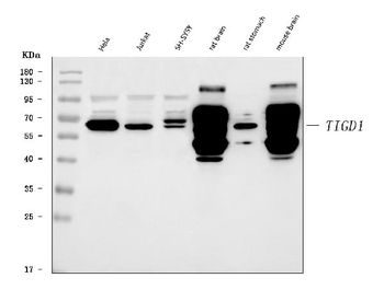 Anti-TIGD1 Antibody