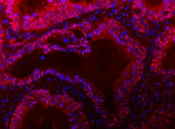 Anti-TIGD1 Antibody