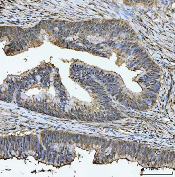 Anti-TIGD1 Antibody