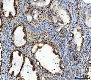 Anti-TIGD1 Antibody