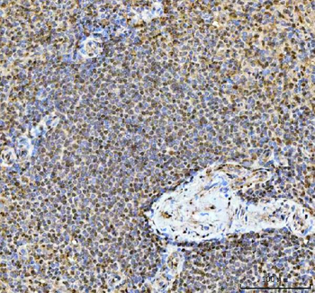 Anti-TIGD1 Antibody