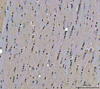Anti-TIGD1 Antibody