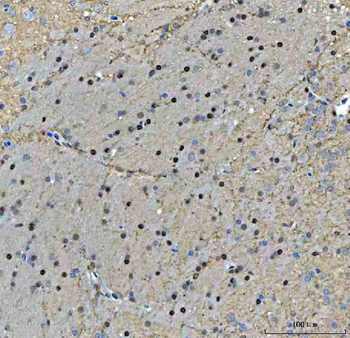 Anti-TIGD1 Antibody