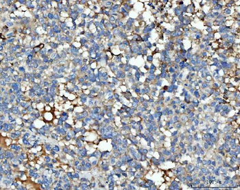 Anti-THBS3 Antibody
