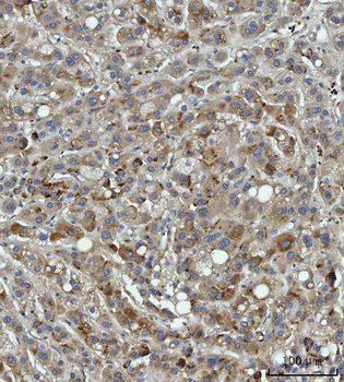 Anti-THBS3 Antibody