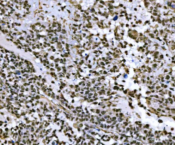 Anti-THAP11 Antibody