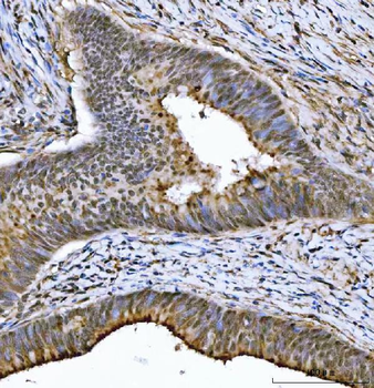 Anti-THAP11 Antibody