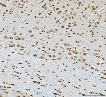 Anti-THAP11 Antibody