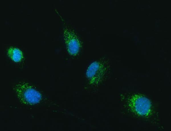 Anti-TRK fused gene/TFG Antibody