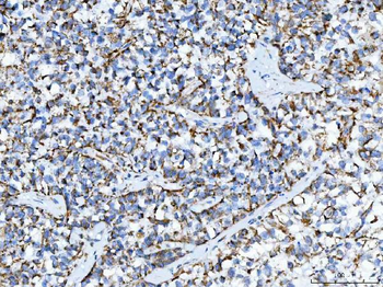 Anti-TRK fused gene/TFG Antibody
