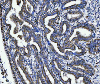 Anti-TRK fused gene/TFG Antibody