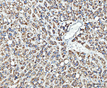 Anti-TRK fused gene/TFG Antibody