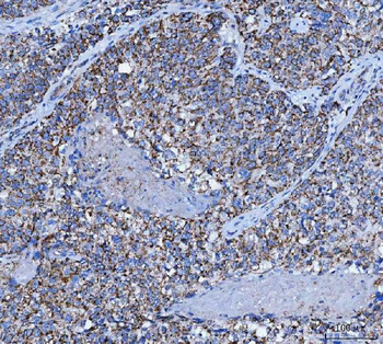 Anti-TRK fused gene/TFG Antibody