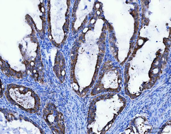 Anti-TRK fused gene/TFG Antibody