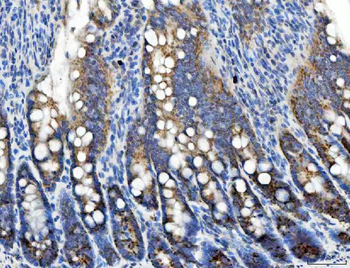 Anti-TRK fused gene/TFG Antibody