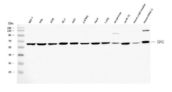 Anti-TRK fused gene/TFG Antibody