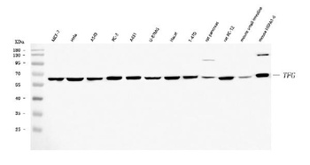 TRK fused gene/TFG Antibody