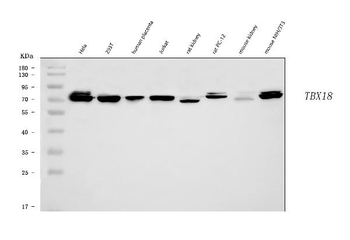 Anti-TBX18 Antibody