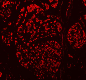 Anti-TBX18 Antibody