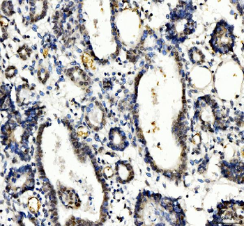 Anti-TBX18 Antibody
