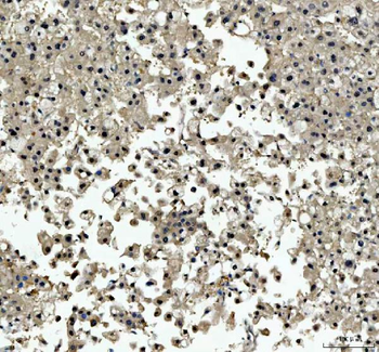 Anti-TBX18 Antibody