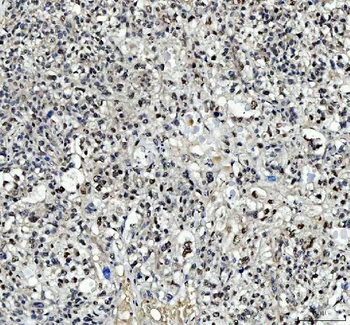 Anti-TBX18 Antibody