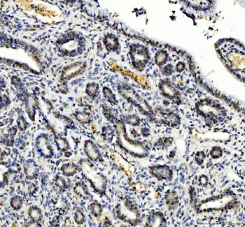 Anti-TBX18 Antibody