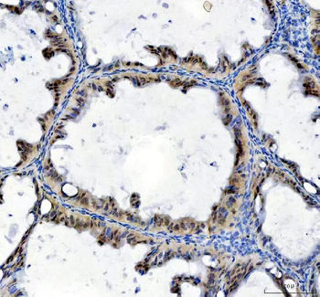 Anti-TBX18 Antibody