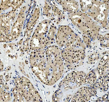 Anti-TBX18 Antibody