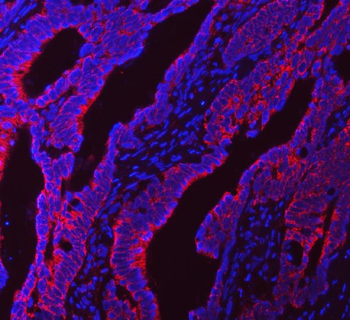 Anti-NDUFS5 Antibody