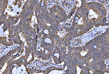 Anti-NDUFS5 Antibody