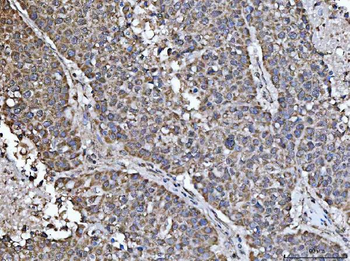 Anti-NDUFS5 Antibody