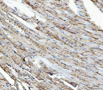 Anti-NDUFS5 Antibody