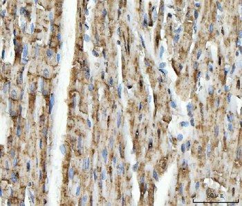 Anti-NDUFS5 Antibody