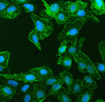 Anti-EPLIN/LIMA1 Antibody