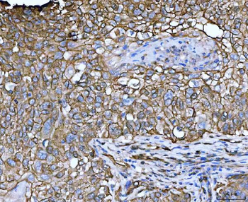 Anti-EPLIN/LIMA1 Antibody