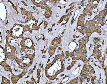 Anti-EPLIN/LIMA1 Antibody