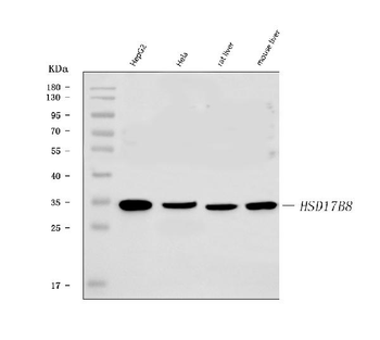 Anti-HSD17B8 Antibody