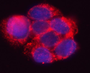 Anti-HSD17B7 Antibody