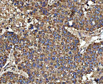 Anti-HSD17B7 Antibody