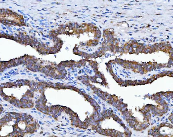 Anti-HSD17B7 Antibody